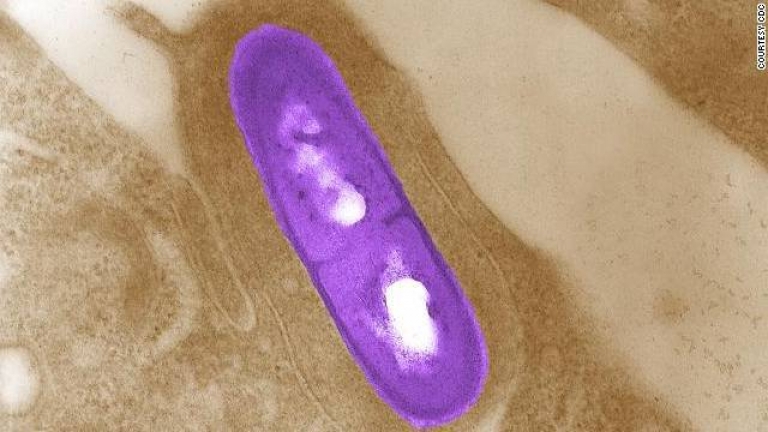 listeria-bacterium-story-top